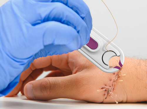 product in use to stitch hand injury